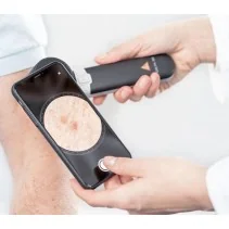 HEINE DELTA 30 Dermatoscope