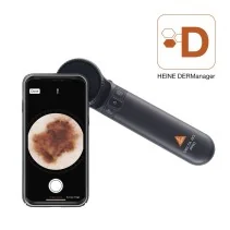 HEINE DELTA 30 PRO High-end dermatoscope