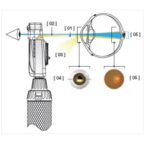 HEINE BETA 200 S LED Ophthalmoscope