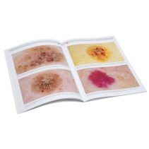 HEINE DELTA 20 T Dermatoscope Set