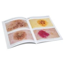 HEINE DELTA 20 T Dermatoscope Set